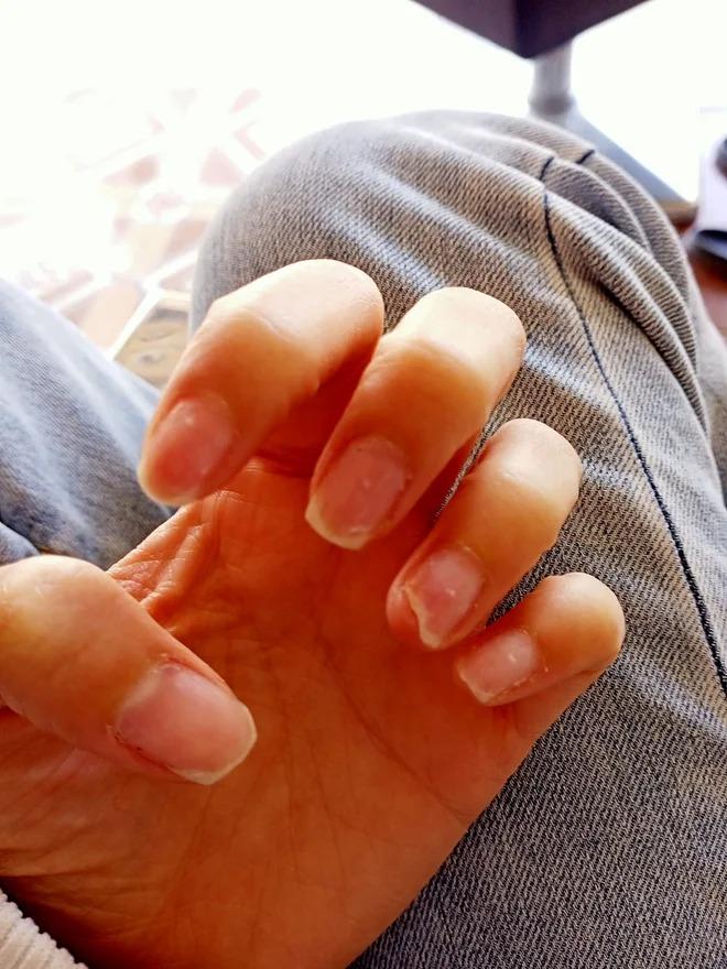 Hoảng hồn với những bộ nail nham nhở sau khi tháo móng giả chơi Tết-9