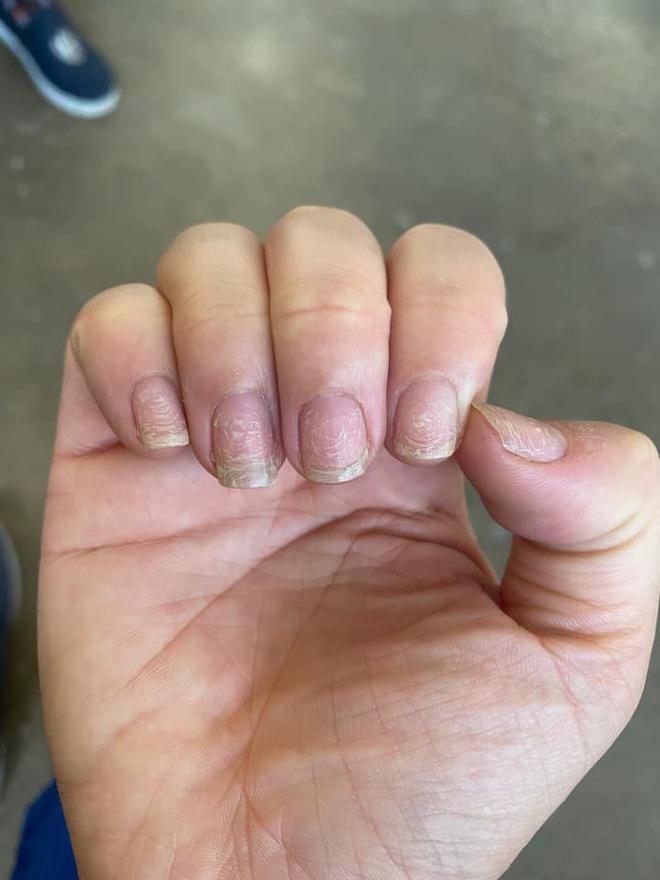 Hoảng hồn với những bộ nail nham nhở sau khi tháo móng giả chơi Tết-10