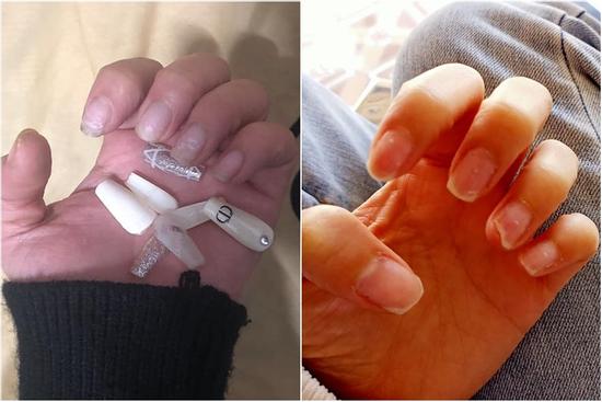 Hoảng hồn với những bộ nail nham nhở sau khi tháo móng giả chơi Tết