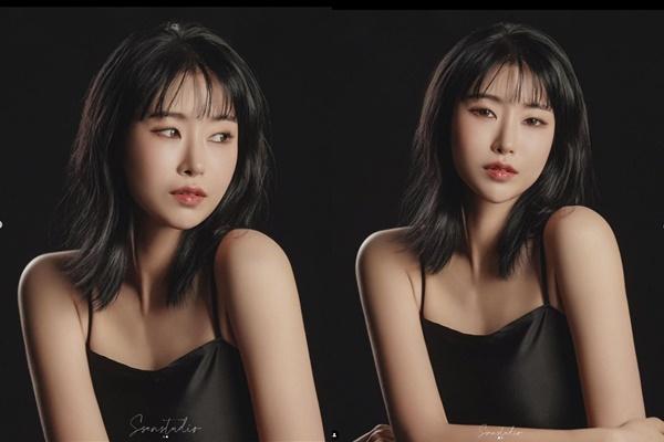 Sao nữ Reply 1988 đổi mặt nhờ thẩm mỹ-1