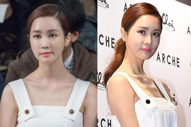 Sắc vóc Lee Da Hae sau nhiều lần thẩm mỹ-7