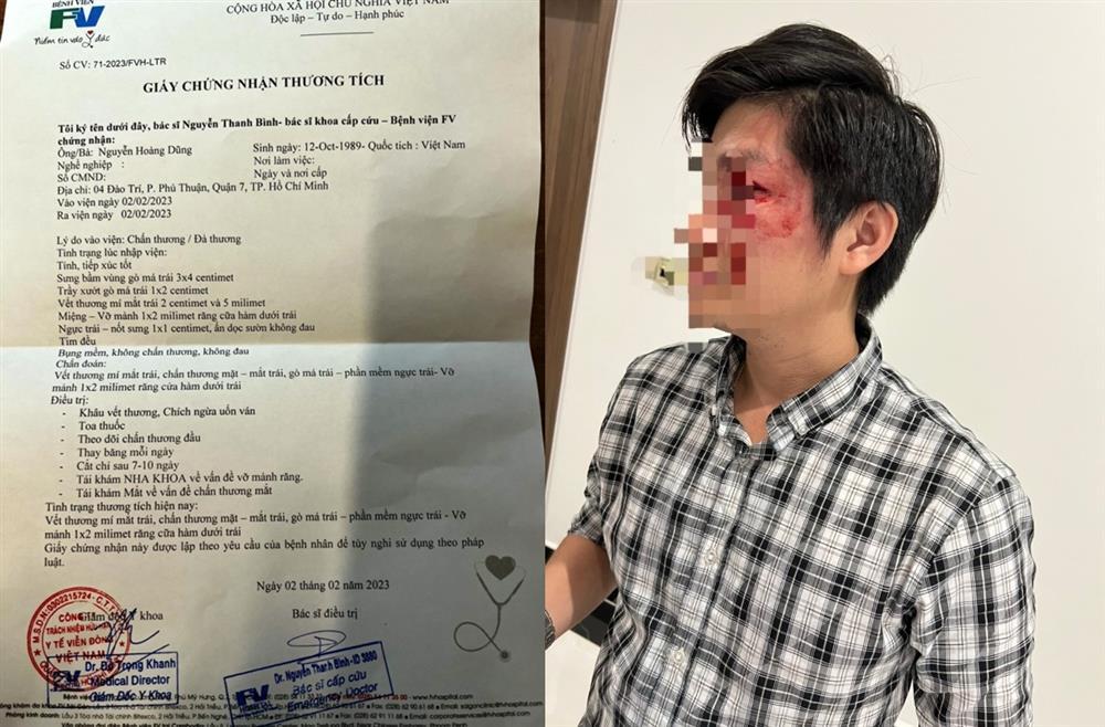 Đuổi chó thả rông bảo vệ con, bố bị chủ chó đấm nát mặt-4