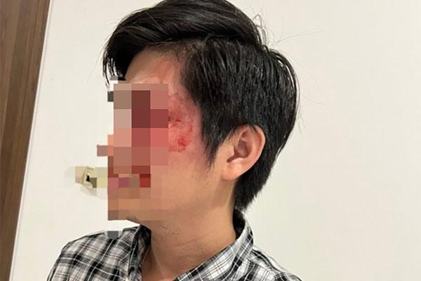 Cho rằng hay bị nói xấu, nhân viên quán cà phê vác dao chém đồng nghiệp-2