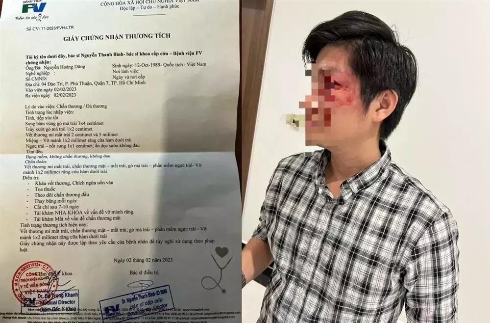 Chủ chó đấm người bố bảo vệ con: Bất ngờ người phụ nữ đi cùng-2