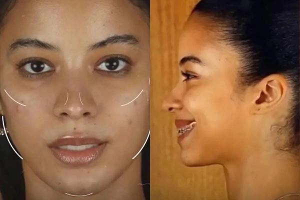 Lộ bằng chứng Á hậu 2 Miss Universe 2022 từng can thiệp thẩm mỹ?-2