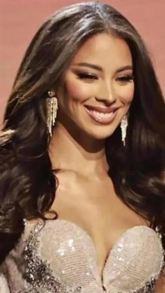 Lộ bằng chứng Á hậu 2 Miss Universe 2022 từng can thiệp thẩm mỹ?-3