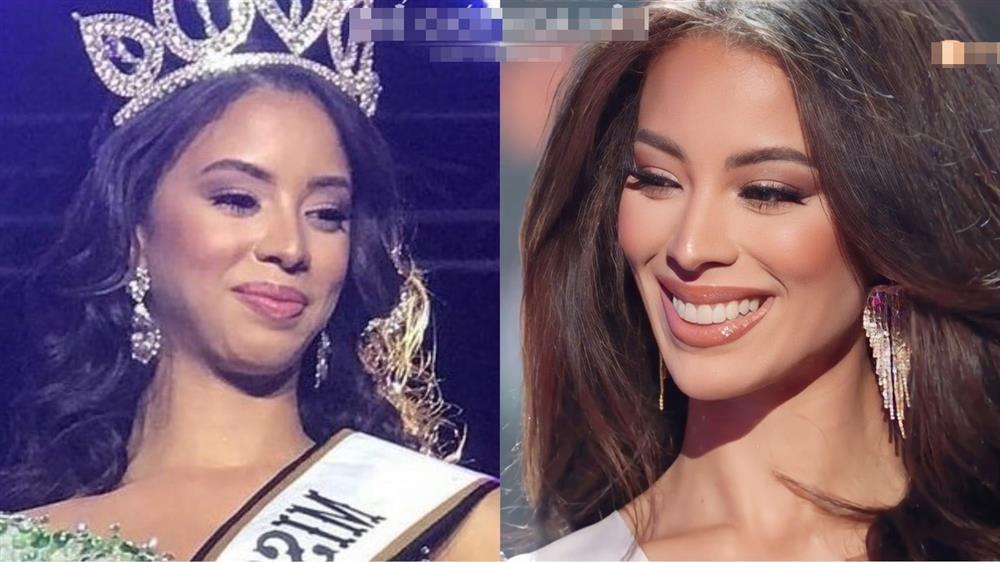 Lộ bằng chứng Á hậu 2 Miss Universe 2022 từng can thiệp thẩm mỹ?-5