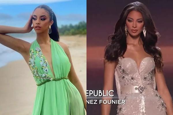 Lộ bằng chứng Á hậu 2 Miss Universe 2022 từng can thiệp thẩm mỹ?-6