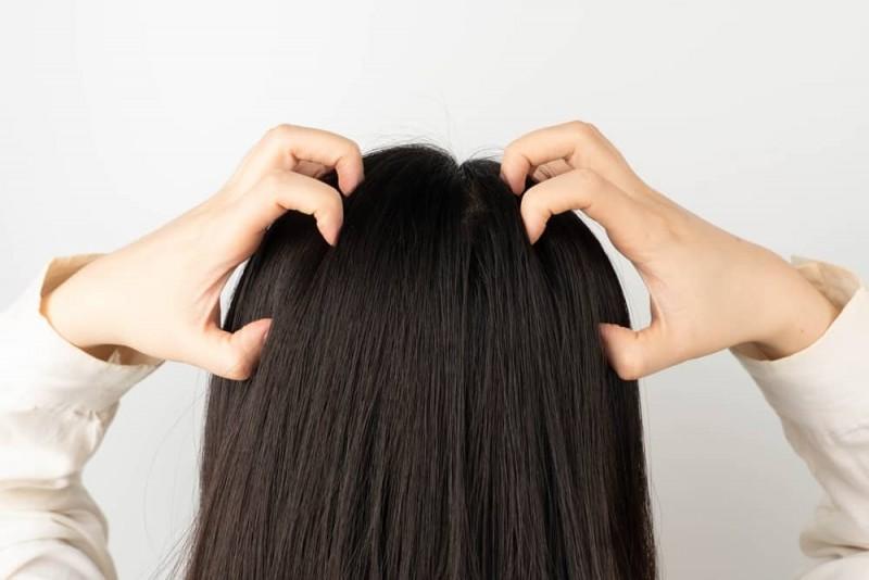 Bí quyết chăm sóc da dầu khi thời tiết nồm ẩm-1