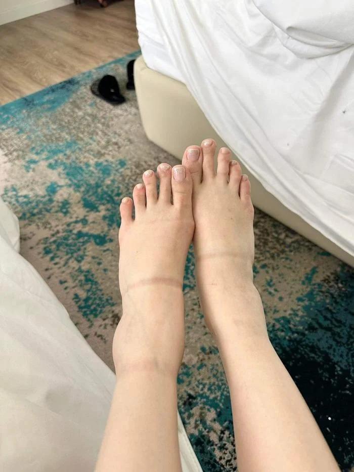 Thanh Thanh Huyền sưng vù đôi chân sau vài ngày thi Miss Charm-4