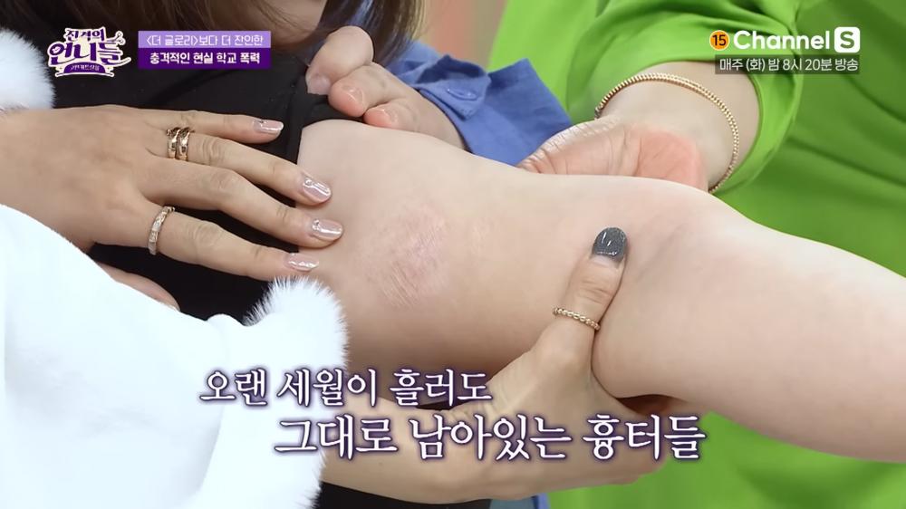 Nạn nhân đời thực trong phim trả thù tàn khốc của Song Hye Kyo-2