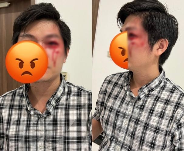 Người bố bị chủ chó đánh vỡ răng quyết không đồng ý hòa giải-1