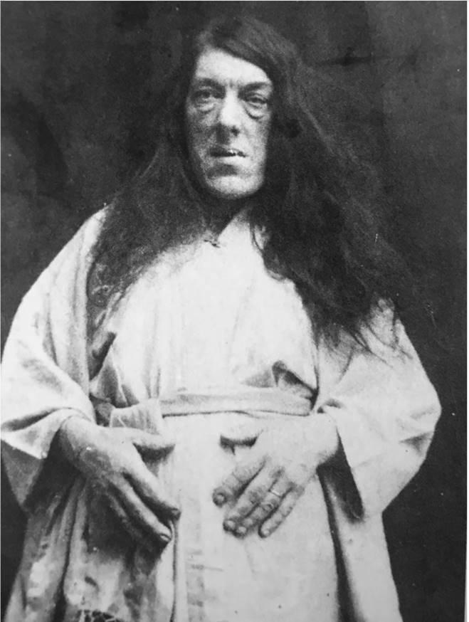 Ảnh hiếm và bi kịch của người phụ nữ xấu xí nhất thế giới-2