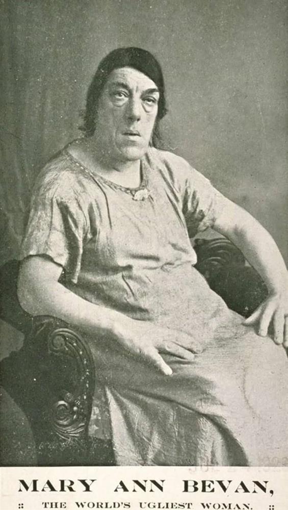 Ảnh hiếm và bi kịch của người phụ nữ xấu xí nhất thế giới-4