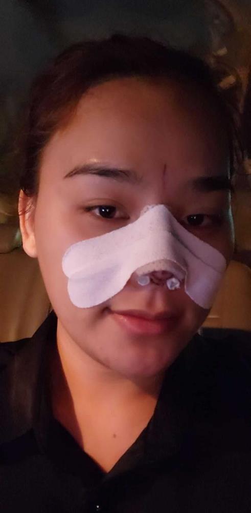 Chi khủng thẩm mỹ, thánh sún Ngân Thảo lạ quá nhận không ra-5