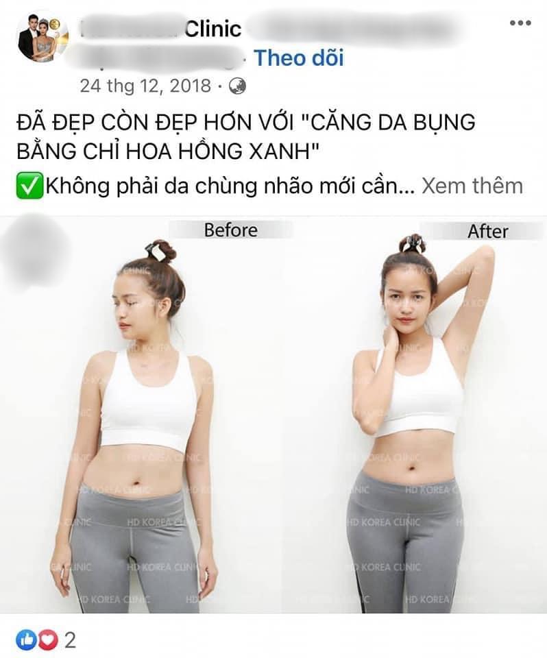 Ngọc Châu lộ ảnh sửa toàn bộ dù nói thời gian đâu phẫu thuật-6