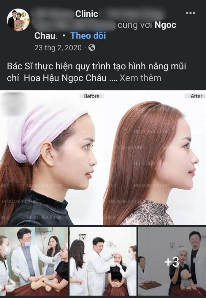 Ngọc Châu lộ ảnh sửa toàn bộ dù nói thời gian đâu phẫu thuật-5
