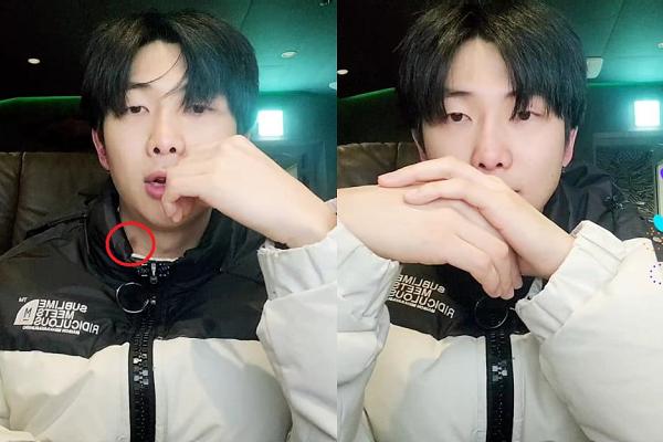 Jin (BTS) gặp chấn thương vai trong thời gian nhập ngũ?-2