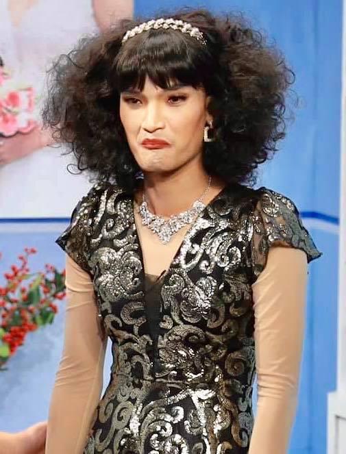 Mạc Văn Khoa không khép được mồm vì xăm môi khử thâm-5