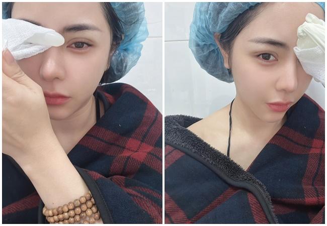 Bạn gái Huỳnh Anh công khai diện mạo mới sang sửa-1