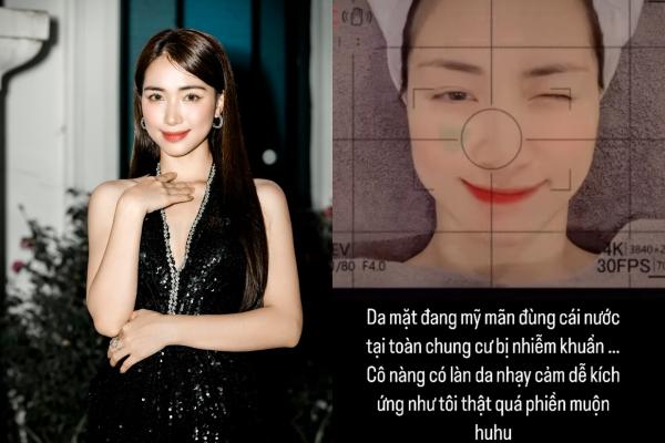 Mất oan 30 triệu đồng, mặt biến dạng sẹo rỗ sau liệu trình điều trị siêu tốc-3