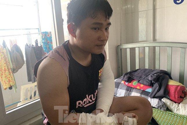 Shipper bị đánh gãy 2 tay: Sắp thi bằng lái B2 thì gặp nạn-6