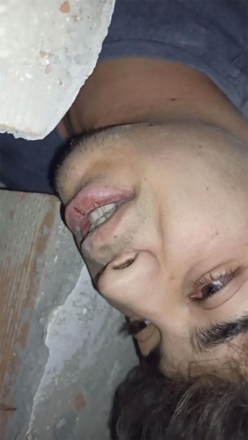 Nam sinh Thổ Nhĩ Kỳ quay lại phút cuối cuộc đời dưới đống đổ nát-1