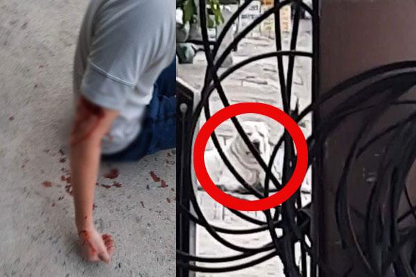 Người đàn ông tử vong sau gần 2 tháng bị chó hoang cắn-2