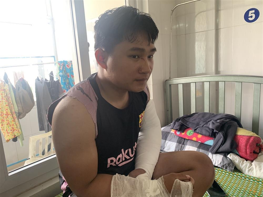 Shipper bị đánh gãy 2 tay: Sắp thi bằng lái B2 thì gặp nạn-1