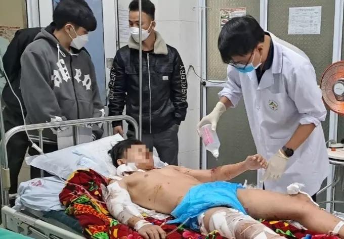 Clip: Khoảnh khắc nam sinh Lào Cai bị 2 con chó hung dữ cắn xé-3