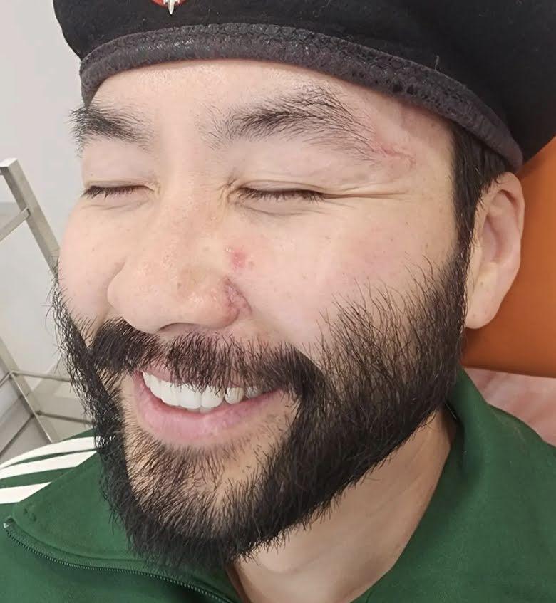Tình hình sức khỏe nam MC xứ Hàn sau tai nạn ở Việt Nam-5