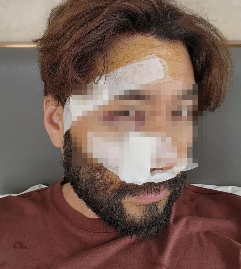 Tình hình sức khỏe nam MC xứ Hàn sau tai nạn ở Việt Nam-4