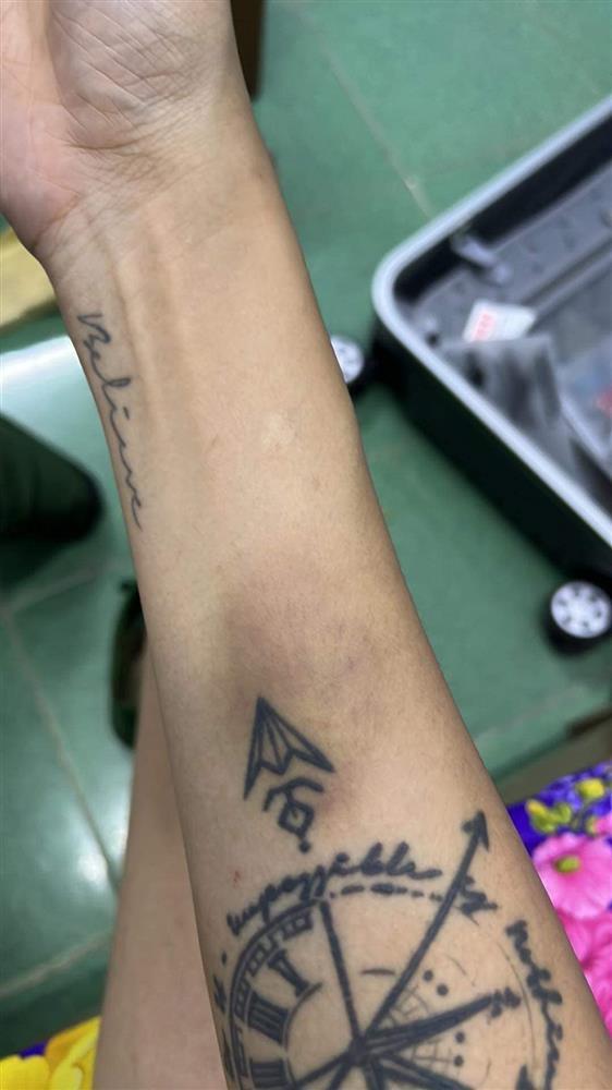 Võ Hoàng Yến bầm dập cơ thể, nhìn mà xót đôi chân bạc tỷ-6