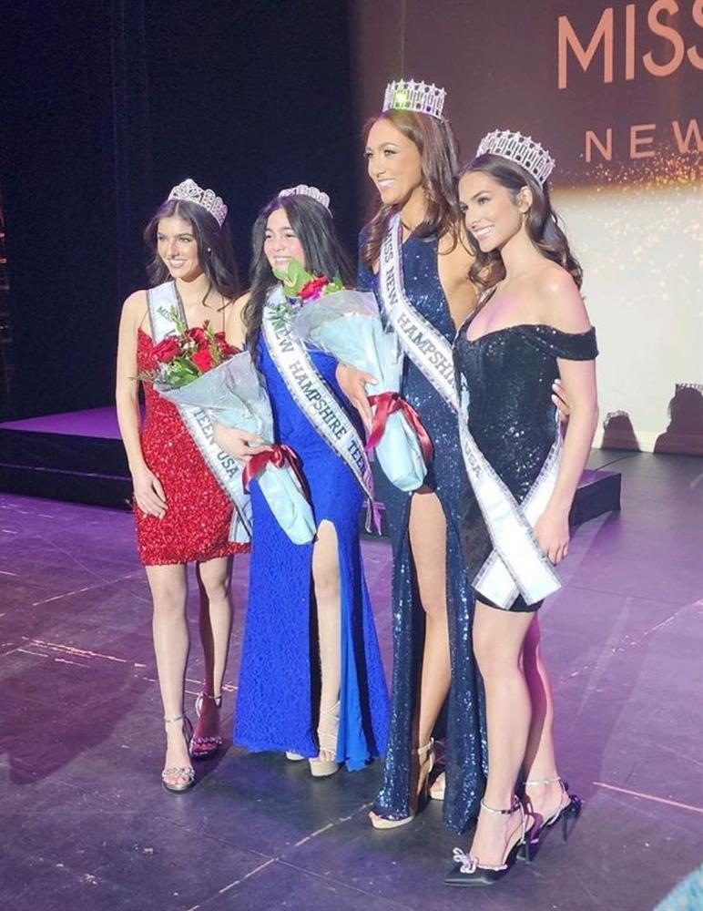 Hoa hậu gây sốc vì cao 1m59, nhan sắc như học sinh tiểu học-9