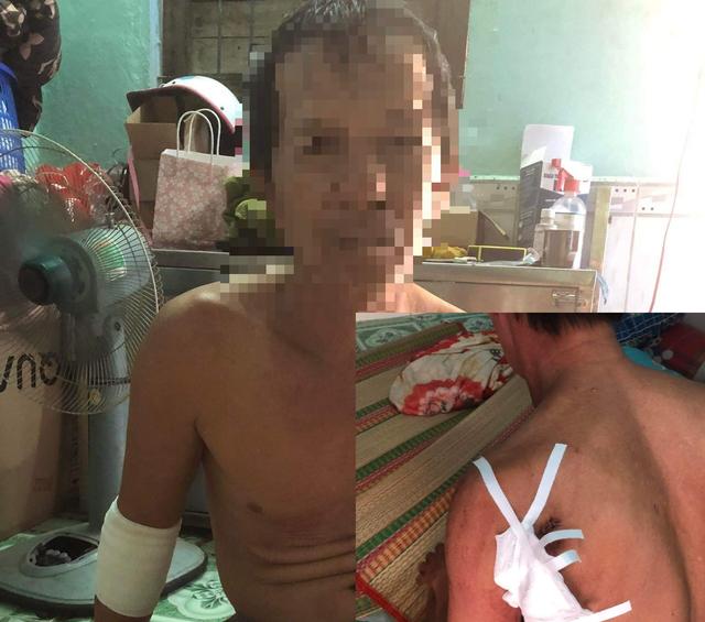 Gay cấn cảnh vây bắt tên trộm xe, lấy dao chém 2 người bị thương-1