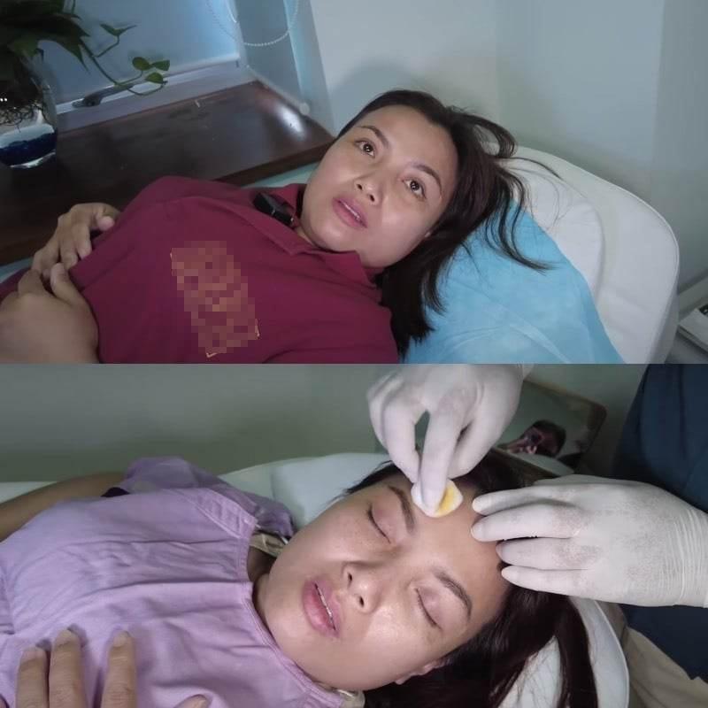 Quỳnh Trần JP trẻ ra cả chục tuổi sau khi khủng dao kéo-9