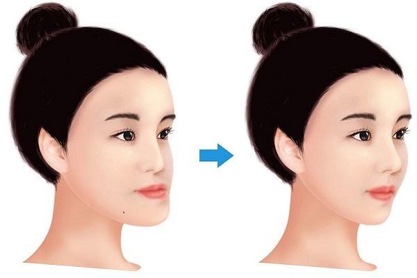 Mặt LƯỠI CÀY gian nan mọi nẻo: Thực hư thế nào?-3