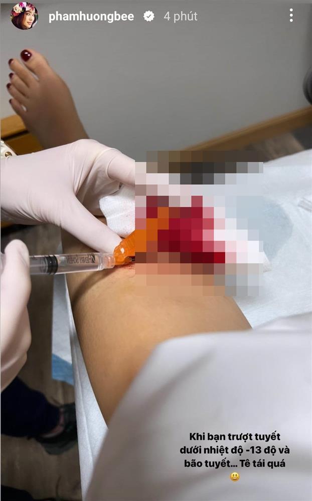 Hoa hậu Phạm Hương gặp sự cố khi trượt tuyết ở Mỹ-3