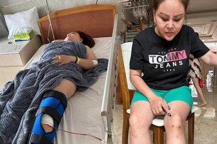 Lê Giang 'Nhà Bà Nữ' nhập viện mổ chân, vết thương 20 năm trước tái phát