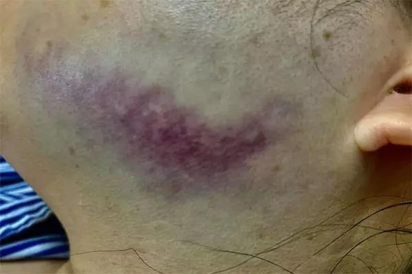 Trưởng phòng công chứng bị đá tím mặt: Đã có kết quả giám định-1