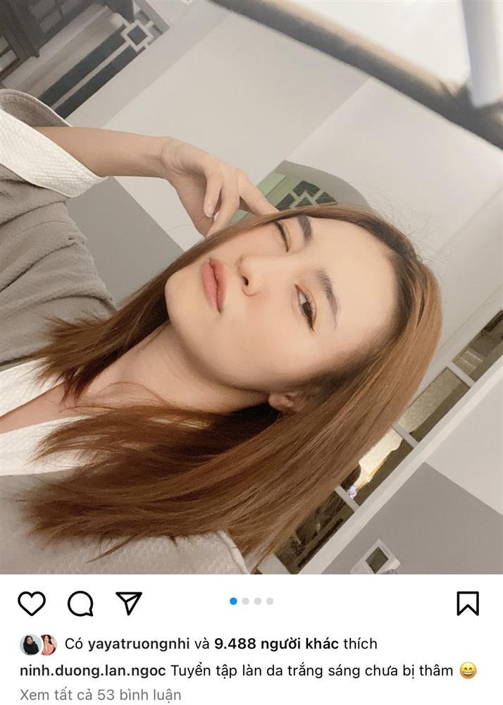 Ninh Dương Lan Ngọc trả giá vì thói quen cực xấu khi bị mụn-3