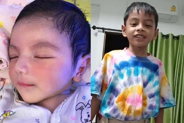 Cuộc sống hiện tại của hai em bé sinh non nhất thế giới-4