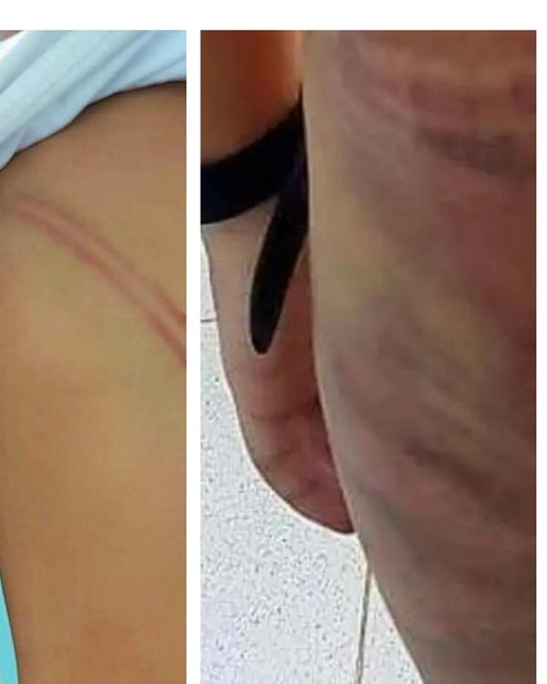 Cà Mau: Bé trai bị mẹ kế đánh bầm tím người vì 20.000 đồng-1