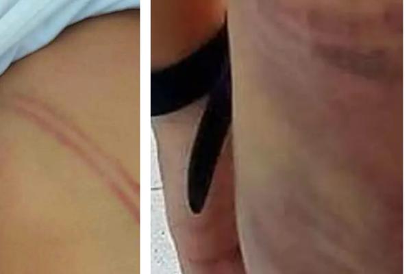 Hà Nội: Trẻ 16 tháng chấn thương não tử vong, nghi bị cô giáo đánh-1