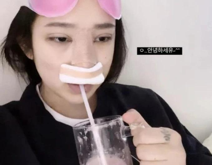 Được khen dậy thì thành công, con gái Choi Jin Sil vẫn sửa sắc đẹp-2