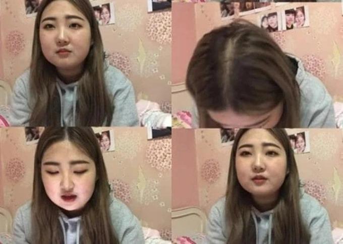 Được khen dậy thì thành công, con gái Choi Jin Sil vẫn sửa sắc đẹp-4