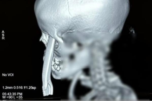 Bé gái 2 tuổi bị xịt hơi cay vào mắt trong vụ xô xát của người lớn-3