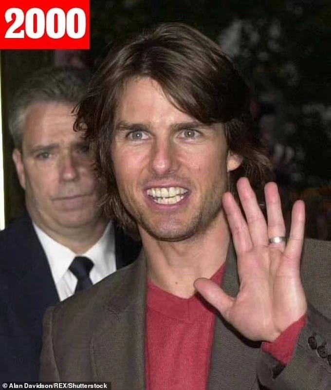Tom Cruise không phải lúc nào cũng... cười đẹp như bây giờ-3