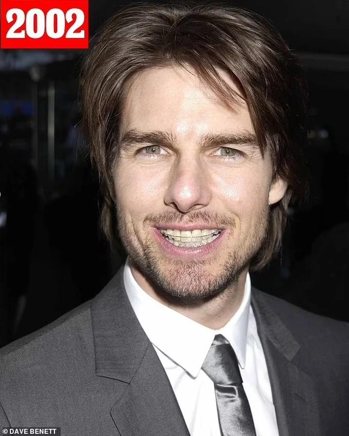 Tom Cruise không phải lúc nào cũng... cười đẹp như bây giờ-4