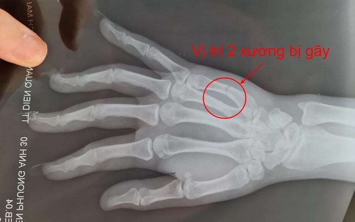 Hà Nội: Công an điều tra vụ người phụ nữ bị đánh sảy thai khi đi ăn tối-1